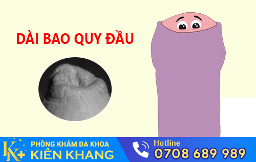 Hình ảnh bao quy đầu dài