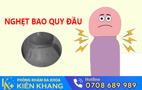 Hình ảnh bệnh về bao quy đầu nghẹt ở nam giới