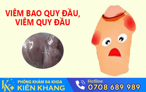 Biểu hiện viêm bao quy đầu ở nam giới