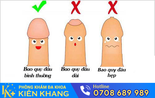 Hình ảnh bao quy đầu bất thường