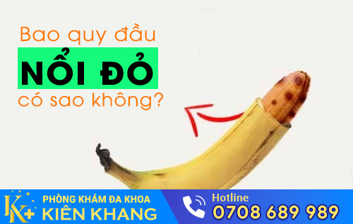 Bao quy đầu nổi đỏ, nổi hạt do nhiều nguyên nhân gây nên