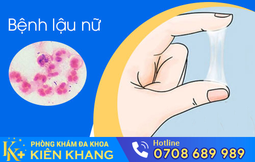 Bệnh lậu khiến chị em đi tiểu ra máu, huyết trắng có mùi khó chịu