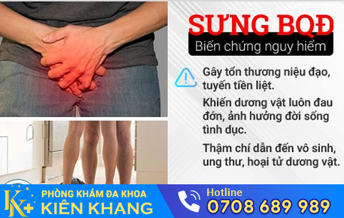 Sưng tấy ở quy đầu dẫn đến nhiều biến chứng nguy hiểm