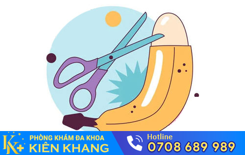 Cắt bao quy đầu bao nhiêu tiền phụ thuộc vào nhiều yếu tố