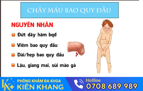 Chảy máu bao quy đầu chớ dại xem thường