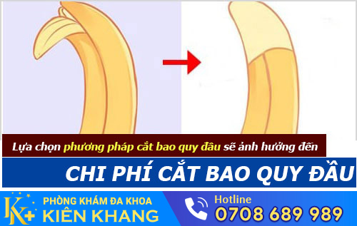 Chi phí cắt bao quy đầu phụ thuộc một phần vào phương pháp