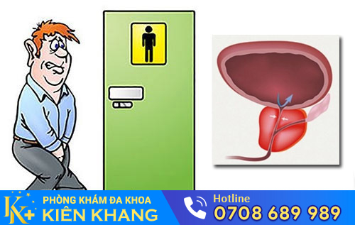 Đau tuyến tiền liệt