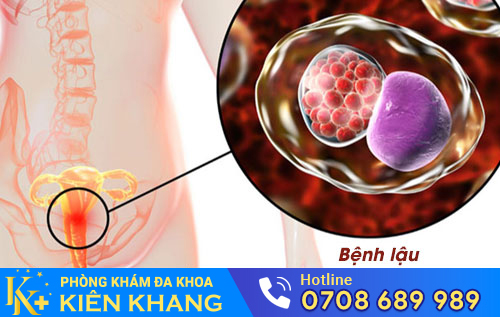 Nguyên nhân đi giải ra máu