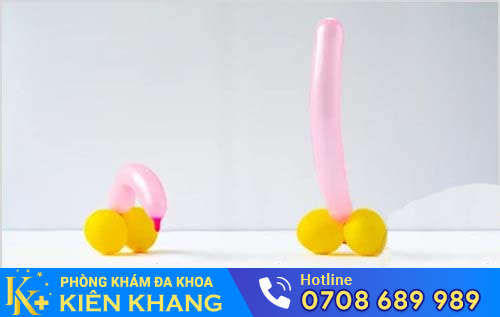 Dương vật mềm - dấu hiệu bệnh rối loạn cương dương