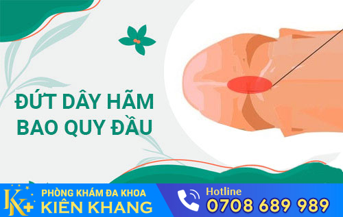Đứt dây hãm bao quy đầu