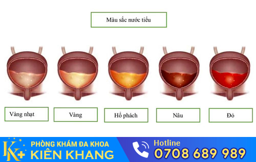 Màu sắc nước tiểu