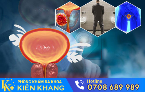 Nguy hại của phì đại tuyến tiền liệt