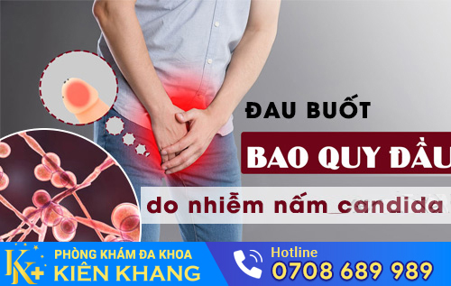 Đau buốt quy đầu do nhiễm nấm candida