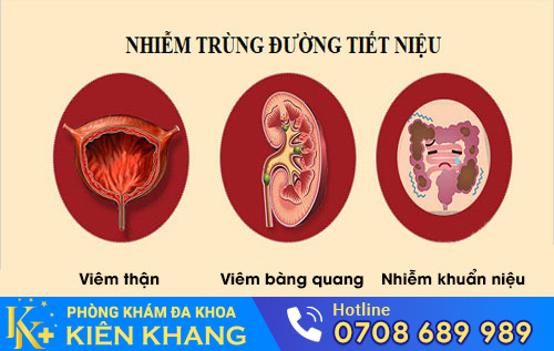 Nguyên nhân dau dương vật sau khi quan hệ
