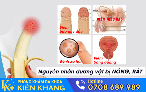 Nguyên nhân dương vật bị nóng rát