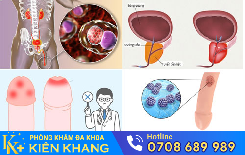 Nguyên nhân gây đau dương vật