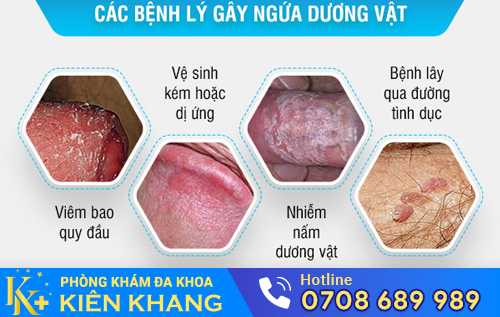 Ngứa bao quy đầu do nhiều nguyên nhân gây nên
