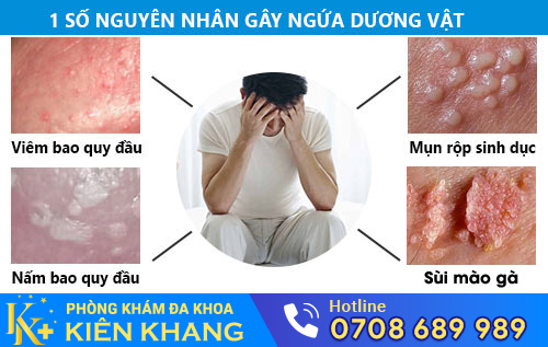 Ngứa dương vật là dấu hiệu nhiều bệnh nguy hiểm