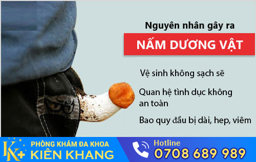 Nấm dương vật