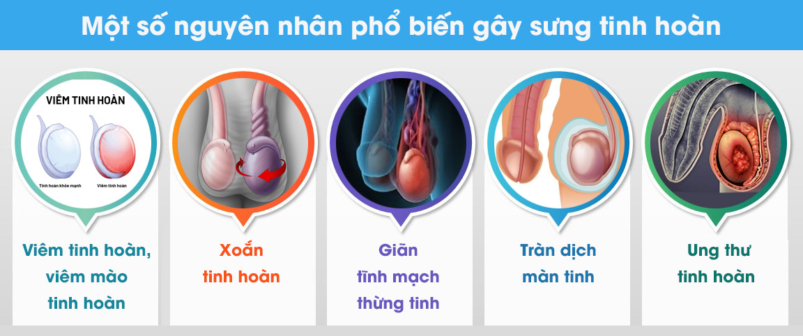 Một số nguyên nhân gây sưng tinh hoàn