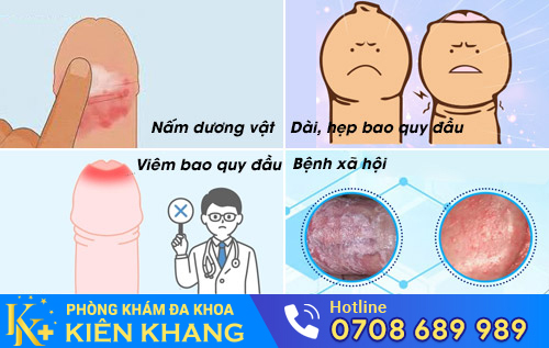 Nguyên nhân gây tróc da dương vật