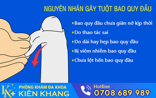 Nguyên nhân gây tuột bao quy đầu