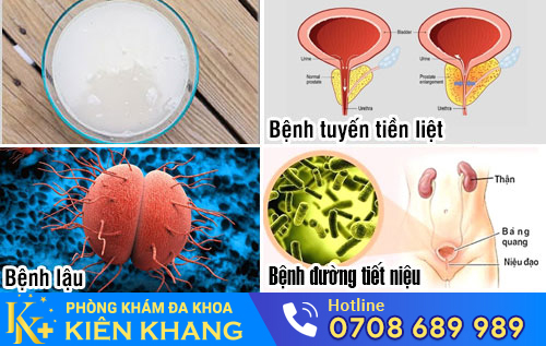 Một số nguyên nhân gây nước tiểu đục