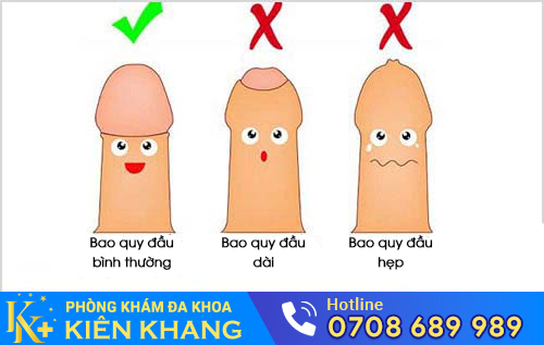 Các dạng bệnh lý cần cắt da bao quy đầu