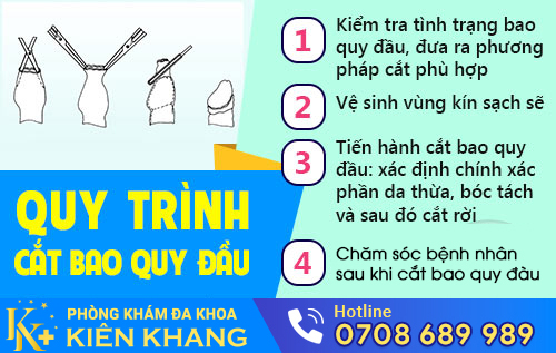 quy-trinh-cat-bao-quy-dau-1
