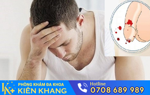 Rách dương vật có thể do nhiều nguyên nhân
