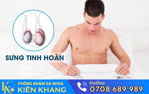Sưng tinh hoàn