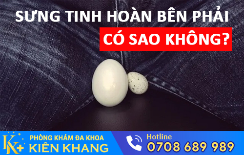 Sưng tinh hoàn bên phải cảnh báo nam giới nhiều bệnh nam khoa nguy hiểm