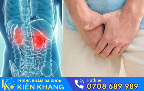 Sưng tinh hoàn một bên là dấu hiệu nhiều bệnh nguy hiểm