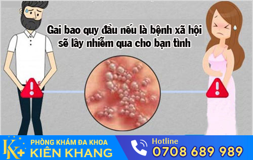 Tác hại của gai bao quy đầu