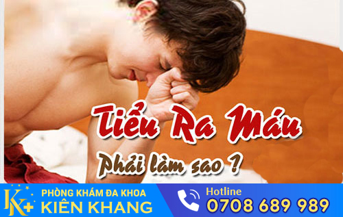 Điều trị tiểu ra máu như thế nào?