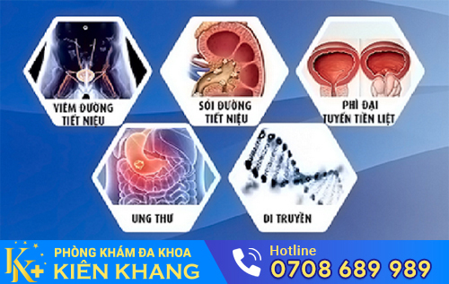 Nhiều bệnh nguy hiểm có thể mắc phải khi tiểu ra máu