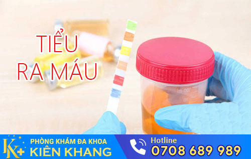 Tiểu ra máu khiến chị em thường xuyên bất an, lo lắng