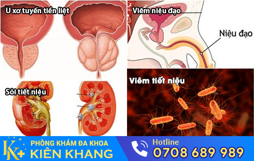 Các nguyên nhân dẫn đến tình trạng tiểu ra máu ở nam
