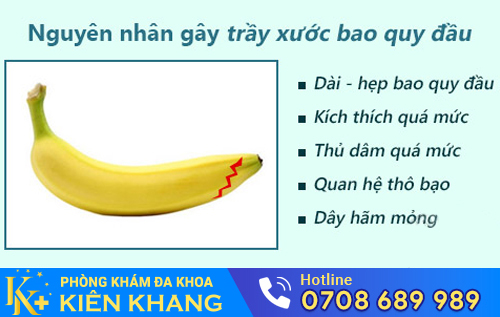 Trầy xước bao quy đầu do nhiều nguyên nhân gây nên