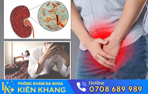 Tác hại không thể xem thường của viêm đường tiết niệu