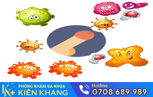 Viêm bao quy đầu là nguyên nhân khiến bao quy đầu đau rát, ngứa, tấy đỏ