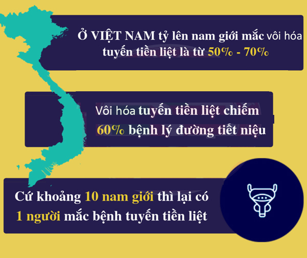 Vôi hóa tuyến tiền liệt