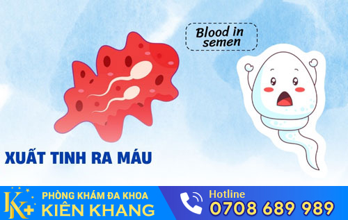 Xuất tinh ra máu