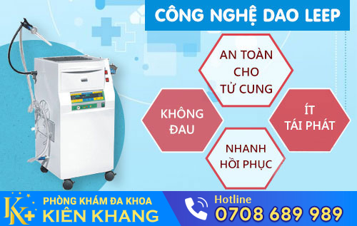 Công nghệ dao Leep