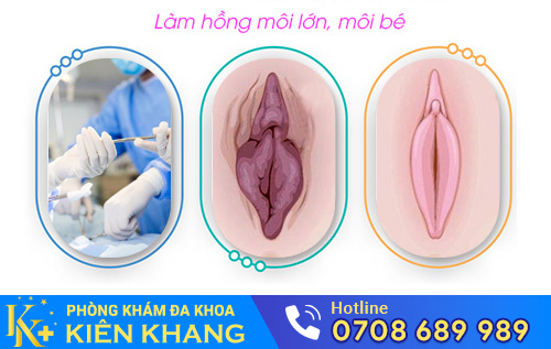Làm hồng môi lớn, môi bé