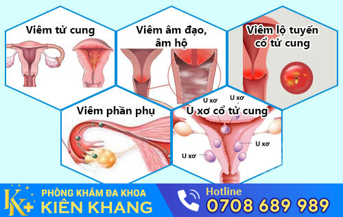 Nguyên nhân huyết trắng có màu