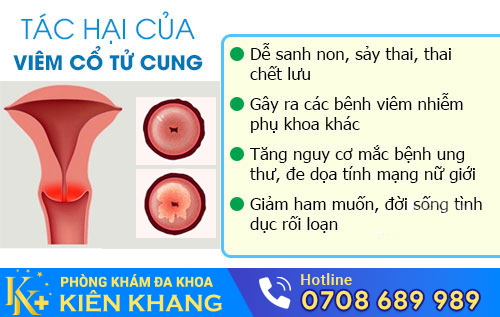 Tác hại từ viêm cổ tử cung