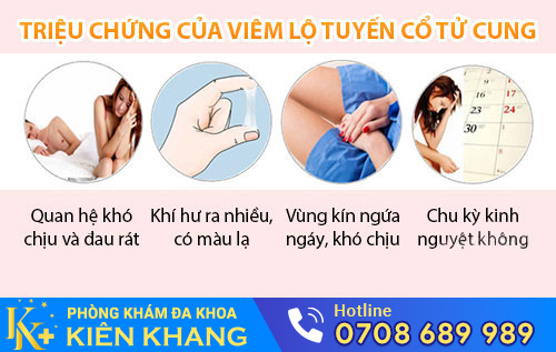 Triệu chứng viêm lộ tuyến cổ tử cung