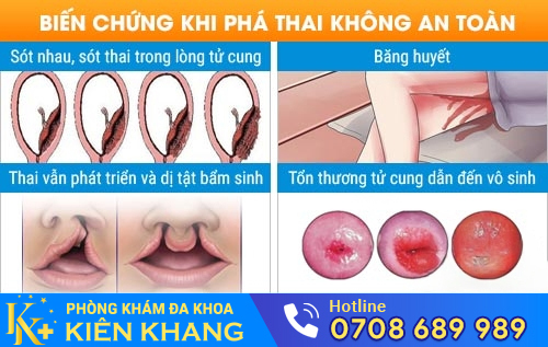 Uống thuốc phá thai không an toàn có thể gây nhiều biến chứng
