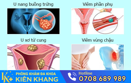 Biểu hiện của các bệnh phụ khoa ở nữ giới